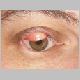 eye.jpg